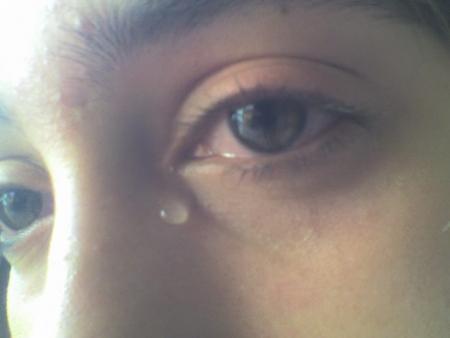 mon oeil